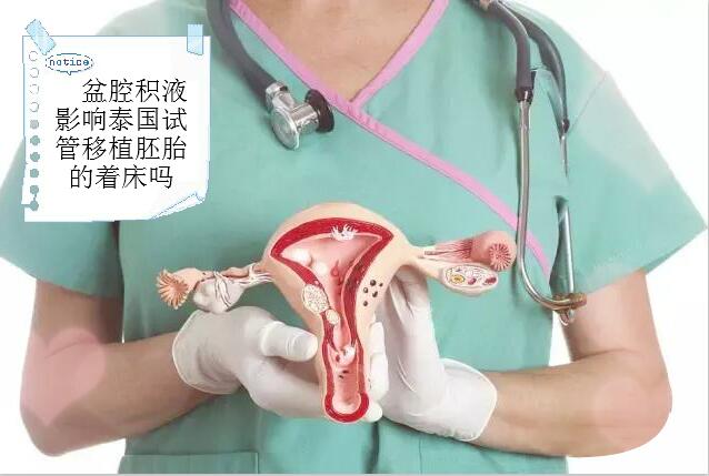 盆腔积液影响泰国试管移植胚胎的着床