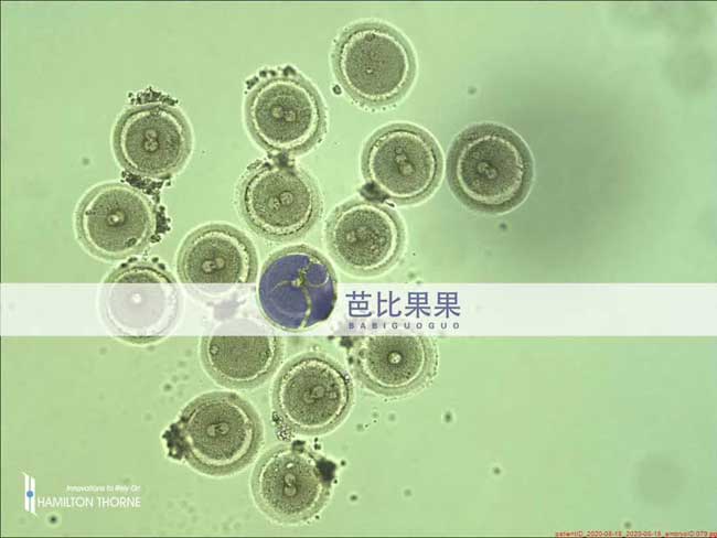 乌克兰丽塔医院先进医疗设备可高清看到受精胚胎的变化