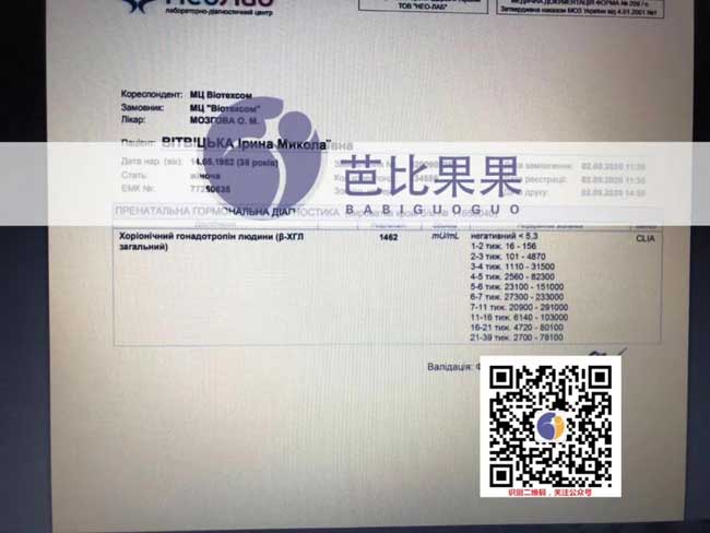 L女士在乌克兰百奥医院经历了两年的波折后终于验孕成功