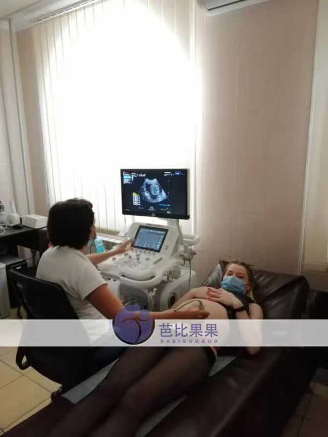 Z女士的乌克兰试管怀上双胞胎在孕20周做的产检