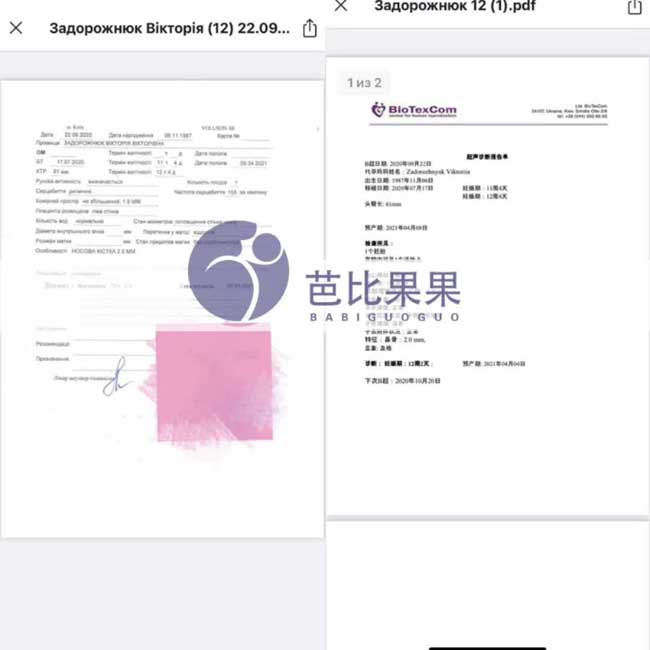 连续收到多位在乌克兰彼奥医院做试管夫妇产检报告