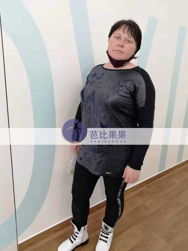 乌克兰代妈做四位彩超