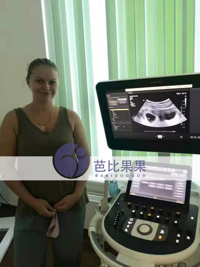 L女士的乌克兰试管移植成功验孕后做第一次B超