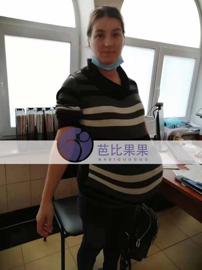 Q先生家的乌克兰孕妇怀双胞胎做36周B超检查