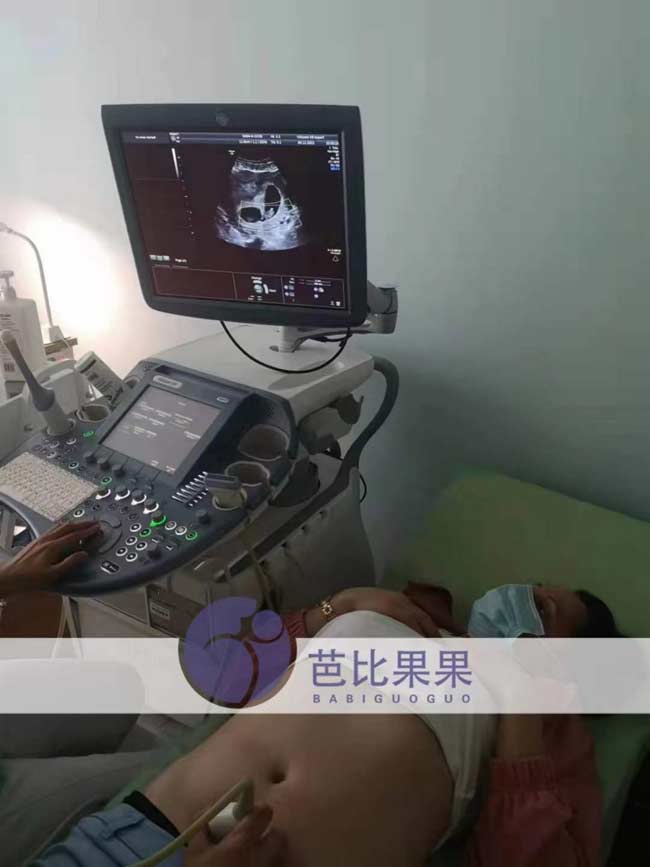 W女士夫妇的乌克兰孕妇母第二次到医院做B超检查