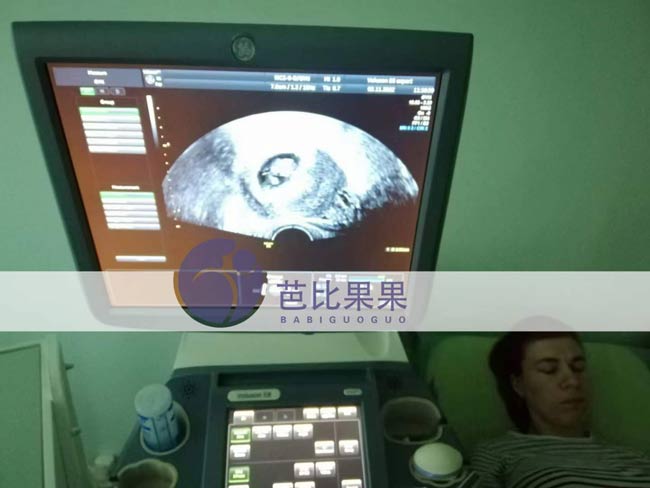 S女士试管妈妈在医院做6-7周B超孕检，胎儿稳稳的发育着