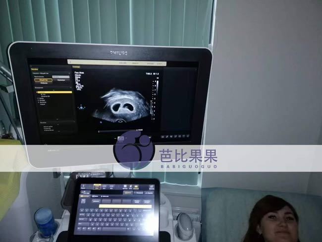 L女士试管妈妈来医院做首次B超确认着床了一个胚胎
