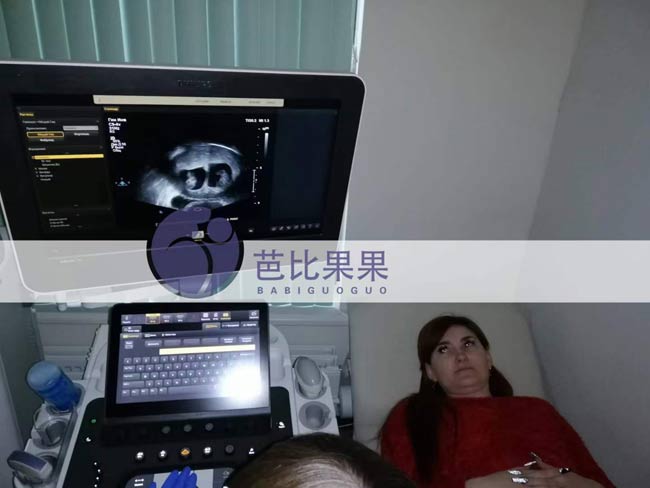 L女士的乌克兰试管妈妈按时来医院做第二次B超