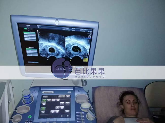 L先生夫妻在丽塔医院试管成功移植后的第一次B超