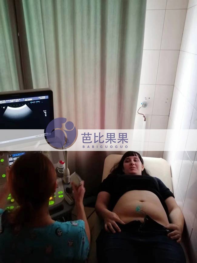 H先生夫妻怀有双胞胎的乌克兰试管妈妈来做B超