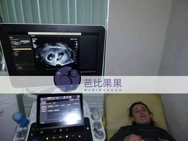 L先生夫妻的乌克兰试管孕妈到医院来做第二次B超
