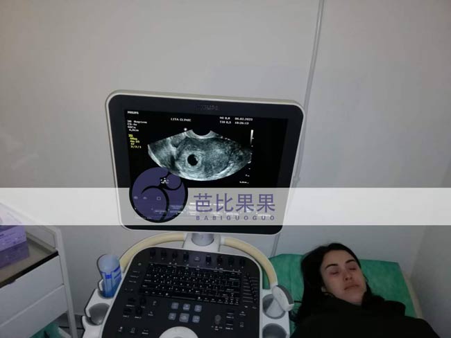 乌克兰试管妈妈做首次B超