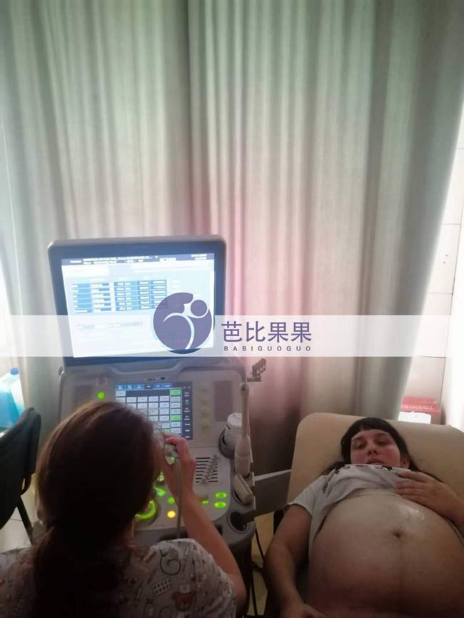 H先生家的乌克兰试管妈妈来医院做孕32周B超