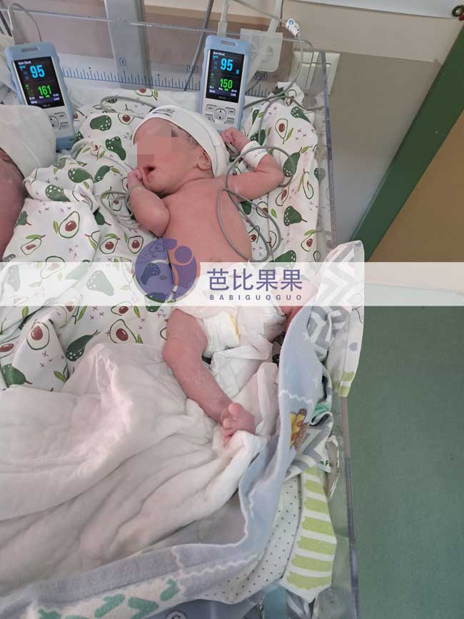 J女士夫妇在格鲁吉亚自卵试管助孕的双胞胎宝宝足月出生