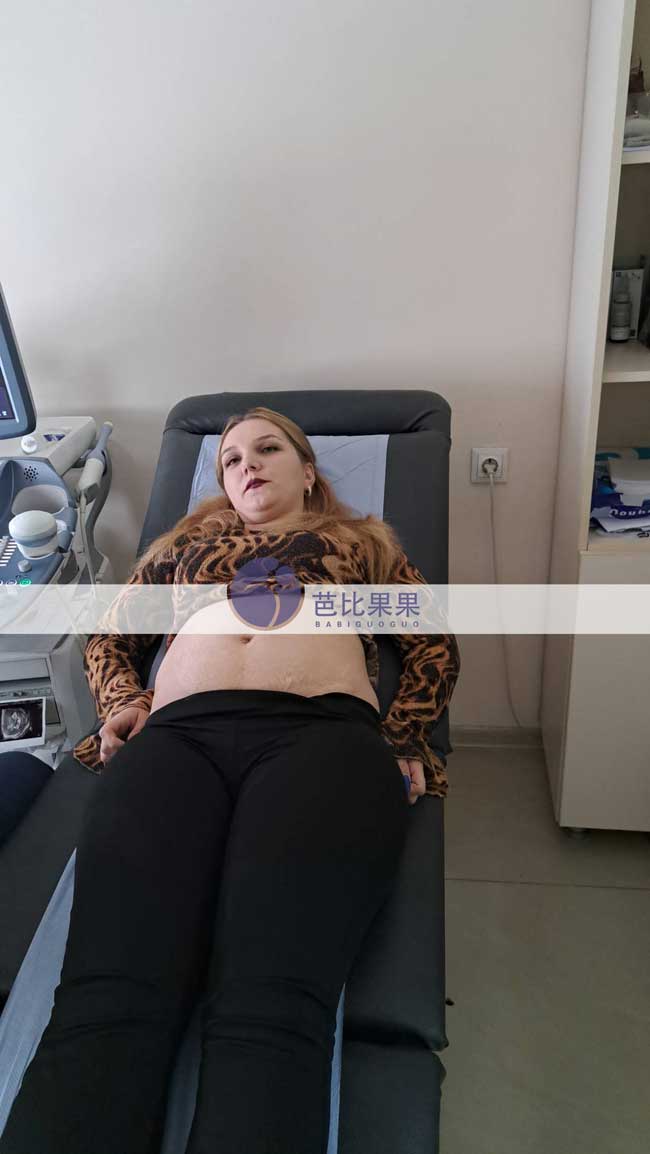 新疆M女士的格鲁吉亚试管妈妈在当地医院做B超产检