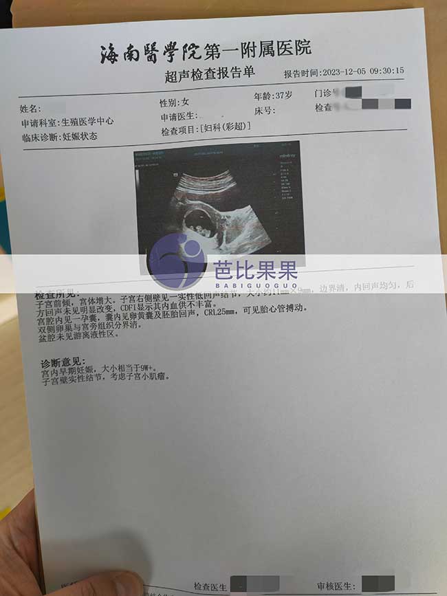 Z女士在海南慈铭医院三代试管移植后的孕9周孕检