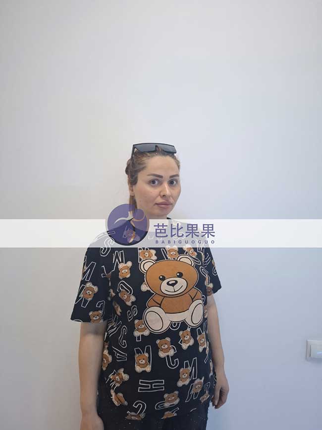 俞先生到格鲁吉亚匹配的试管妈妈来做四维检查