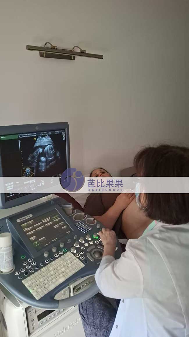 试管妈妈做四维彩超