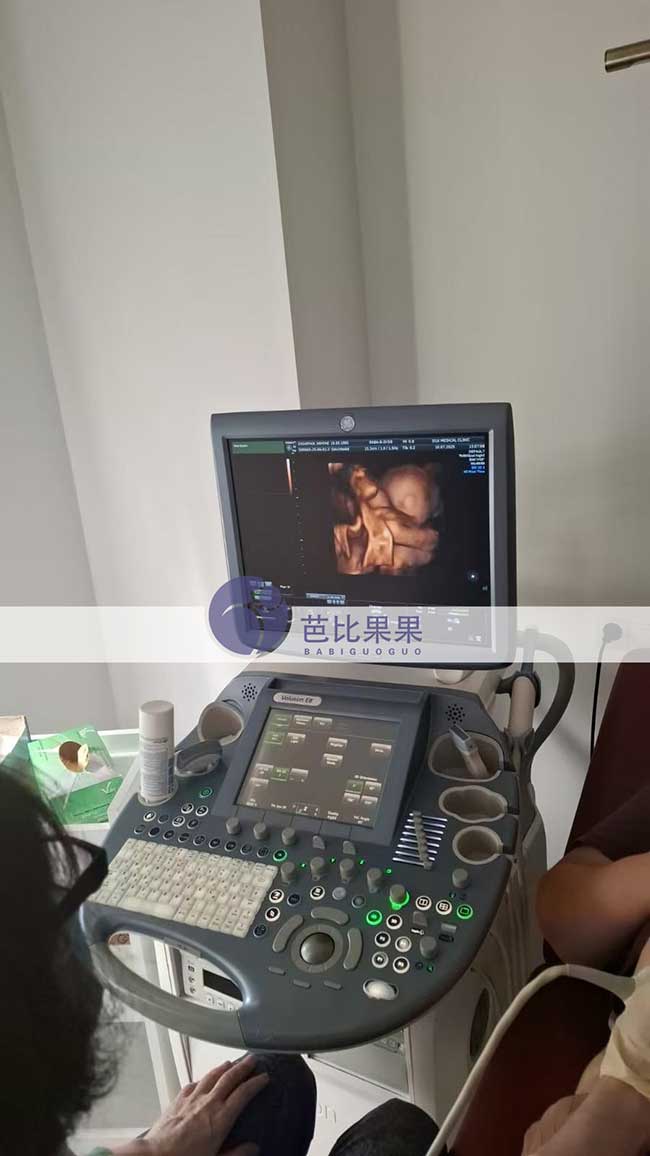 试管妈妈做四维彩超