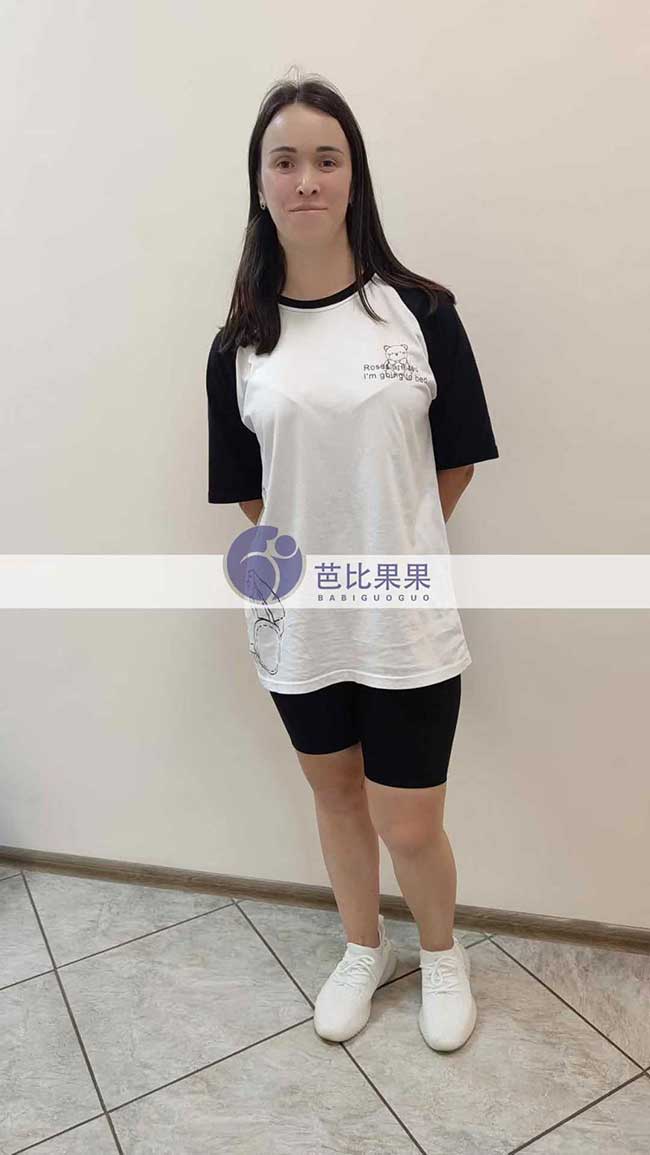 庞女士夫妇再次到乌克兰试管匹配的试管妈妈来医院做B超