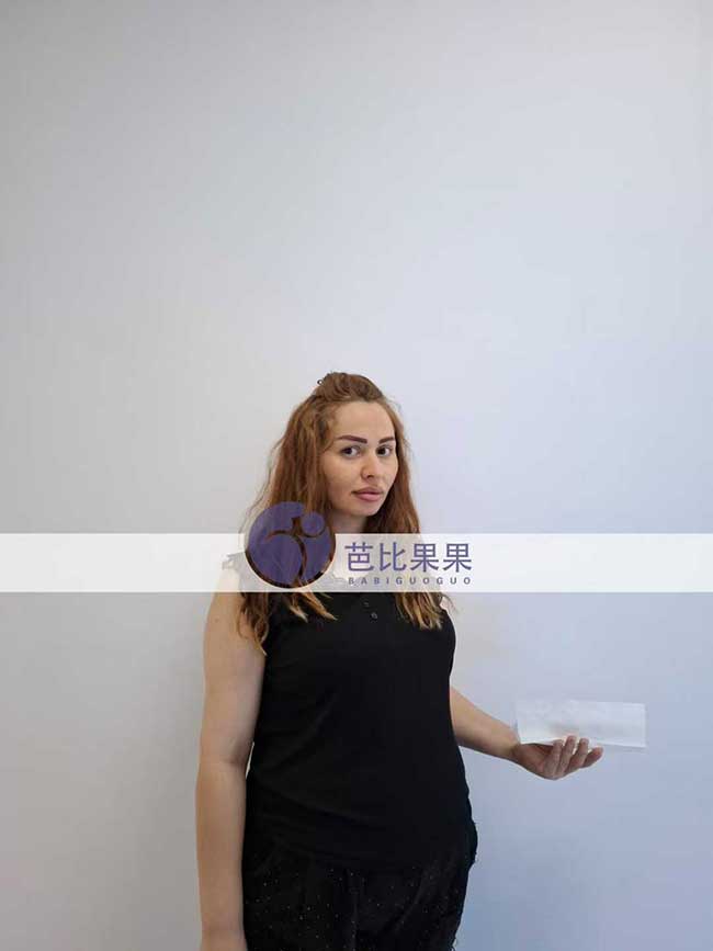 叶先生到格鲁吉亚匹配的试管妈妈来医院做B超