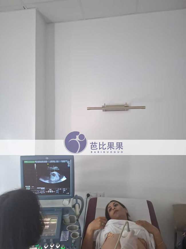 汪先生到格鲁吉亚匹配的试管妈妈来医院做四维彩超