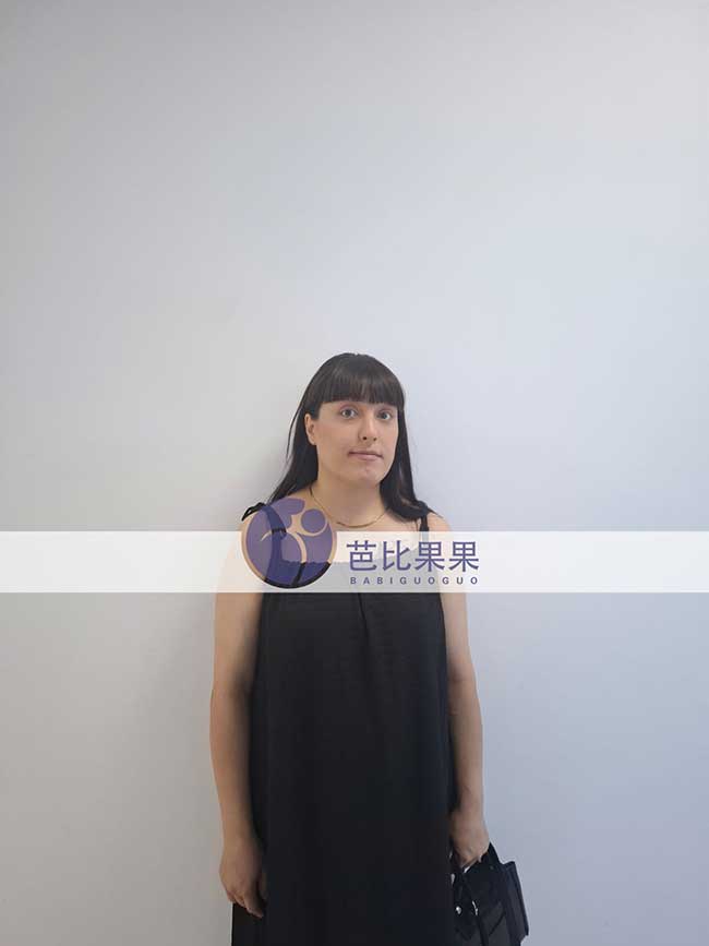 上海李先生到格鲁吉亚匹配的试管妈妈做孕27周+B超产检