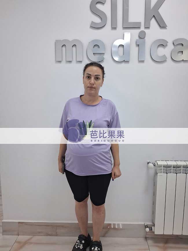 彭女士夫妇到格鲁吉亚匹配的试管妈妈来医院做四维彩超