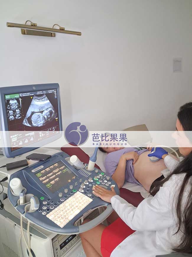 试管妈妈做四维彩超