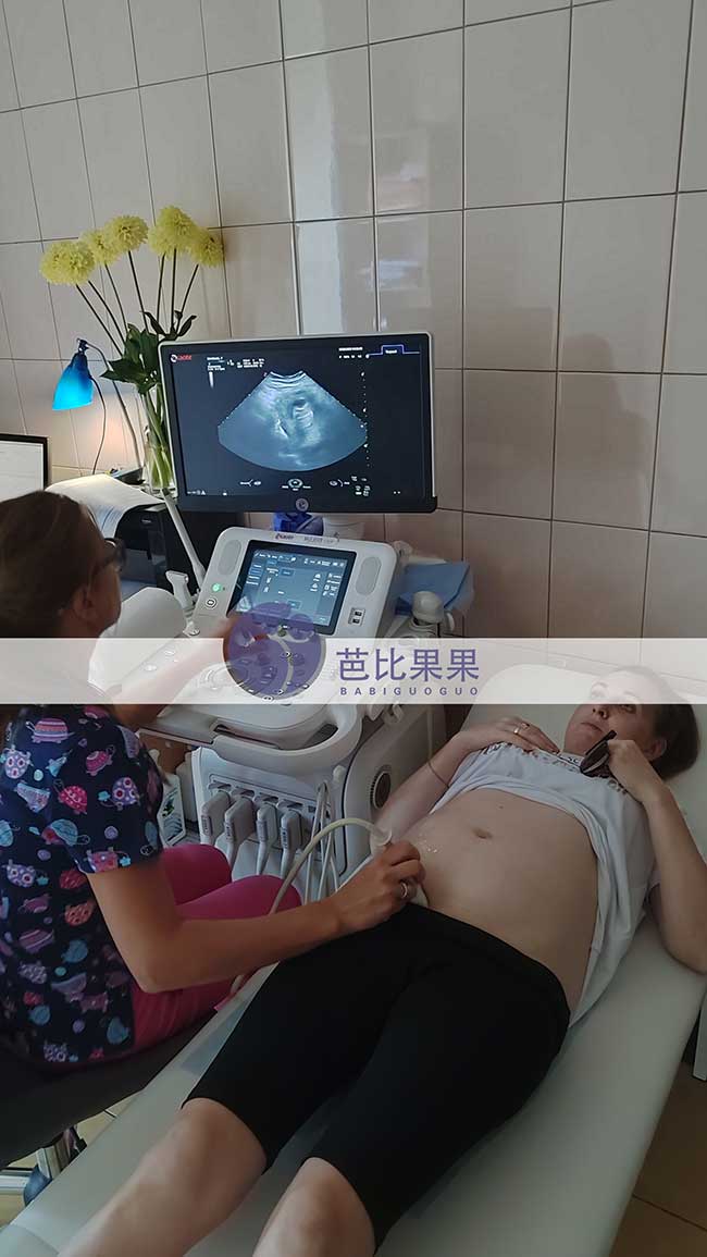 试管妈妈做四维彩超