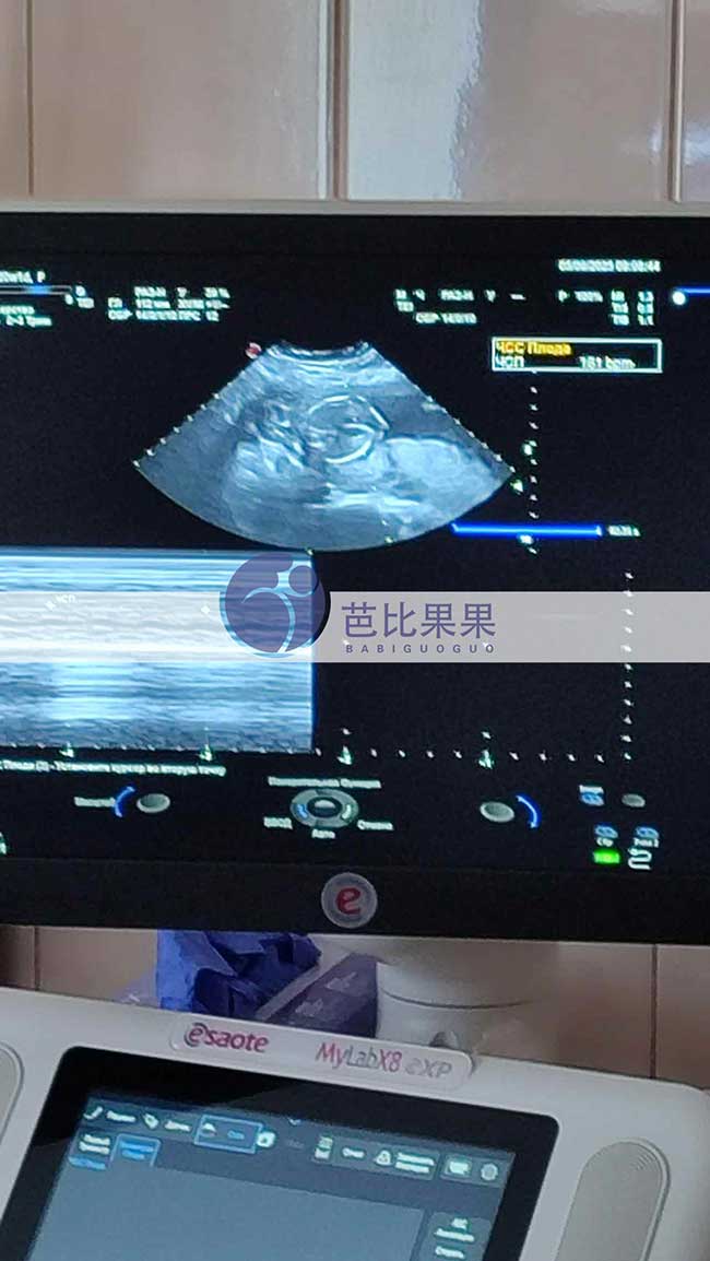 试管妈妈做B超
