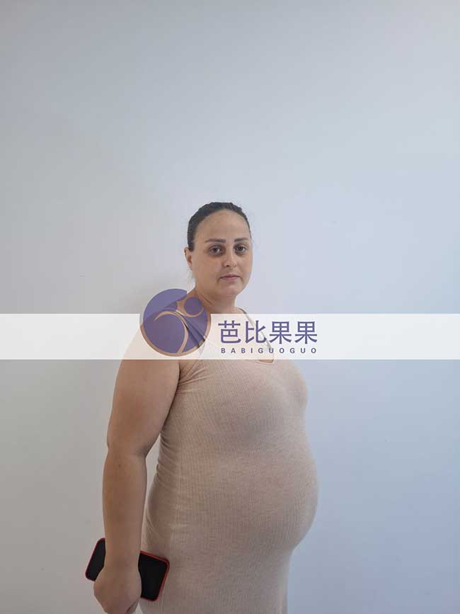 孕后期试管妈妈做B超