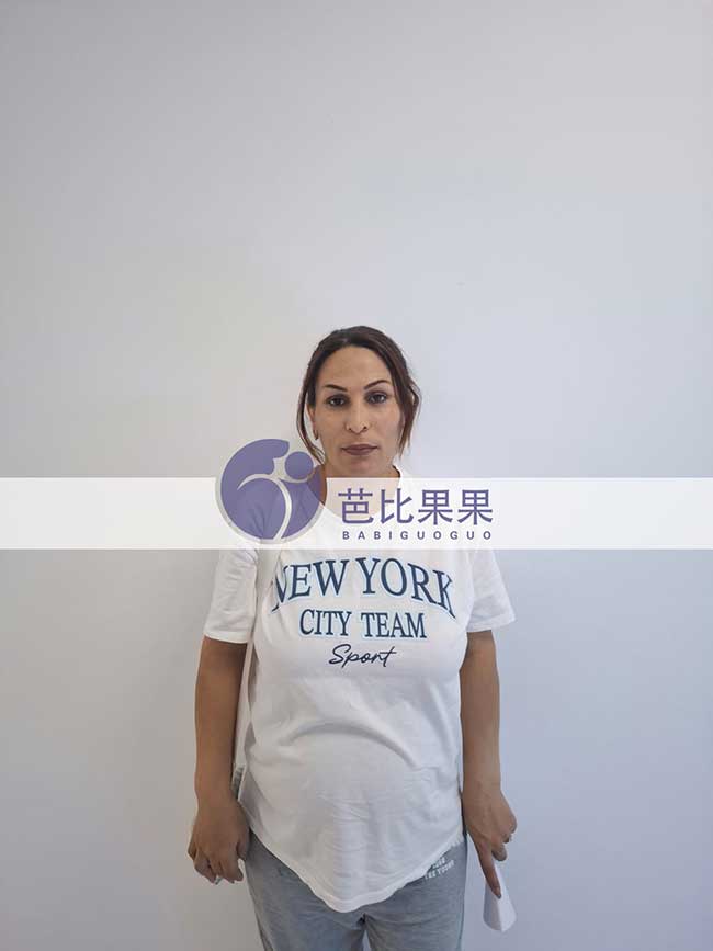 试管妈妈做B超