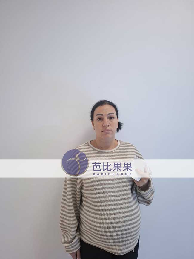 试管妈妈做B超
