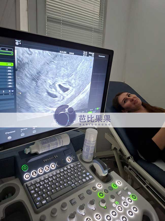 双胞胎试管妈妈做B超