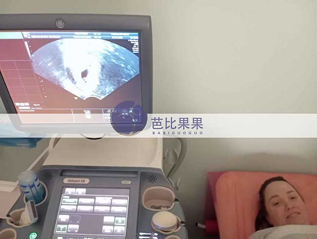 岑先生再次到乌克兰生娃匹配的试管妈妈做首次B超