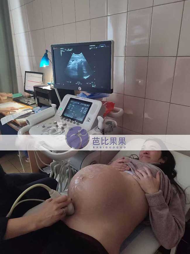 试管妈妈孕37周产检