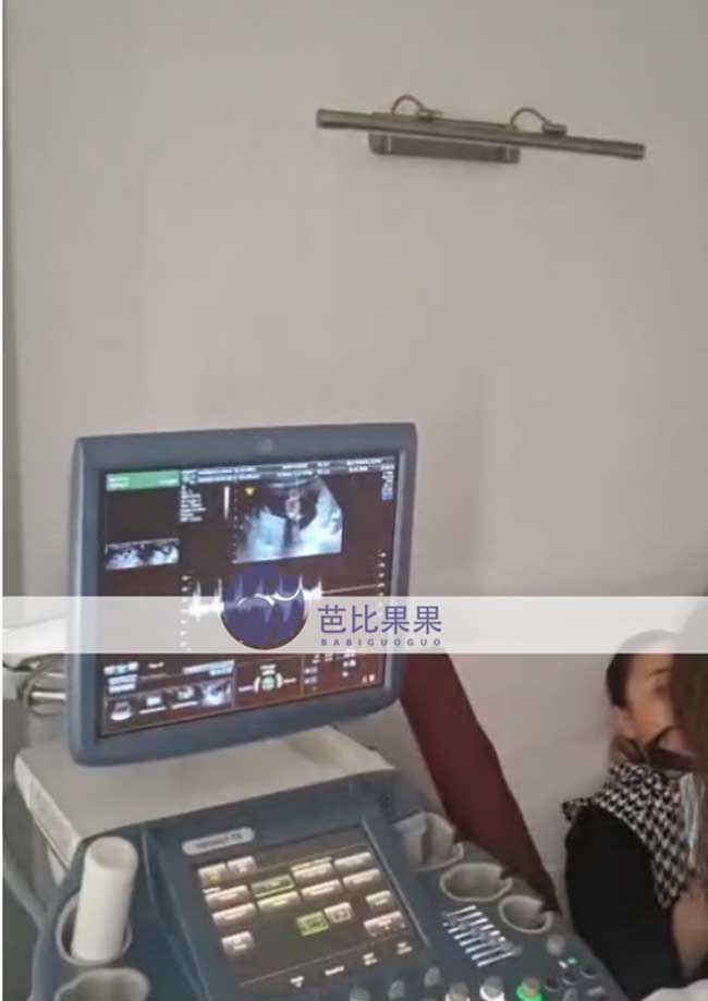 吴女士夫妇到格鲁吉亚自卵生娃的匹配的试管妈妈完成B超产检