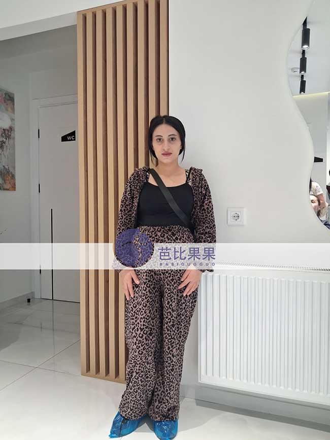 格鲁吉亚试管家庭迎来新进展，两位宝宝B超检查顺利通过
