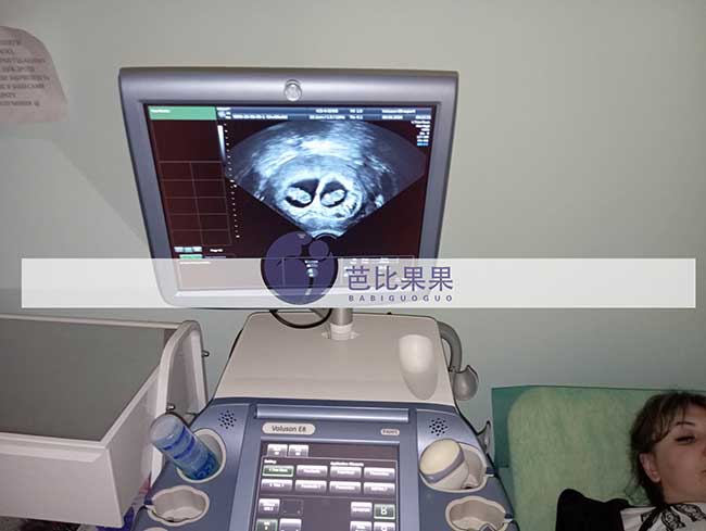 乌克兰试管二胎案例更新：张先生家庭双胎孕早期B超顺利通过