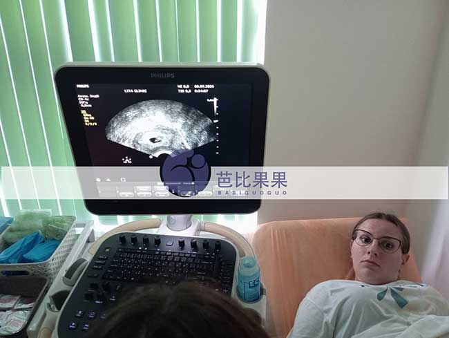 试管妈妈首次B超