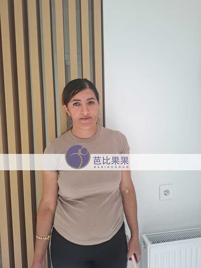 试管妈妈12周孕检