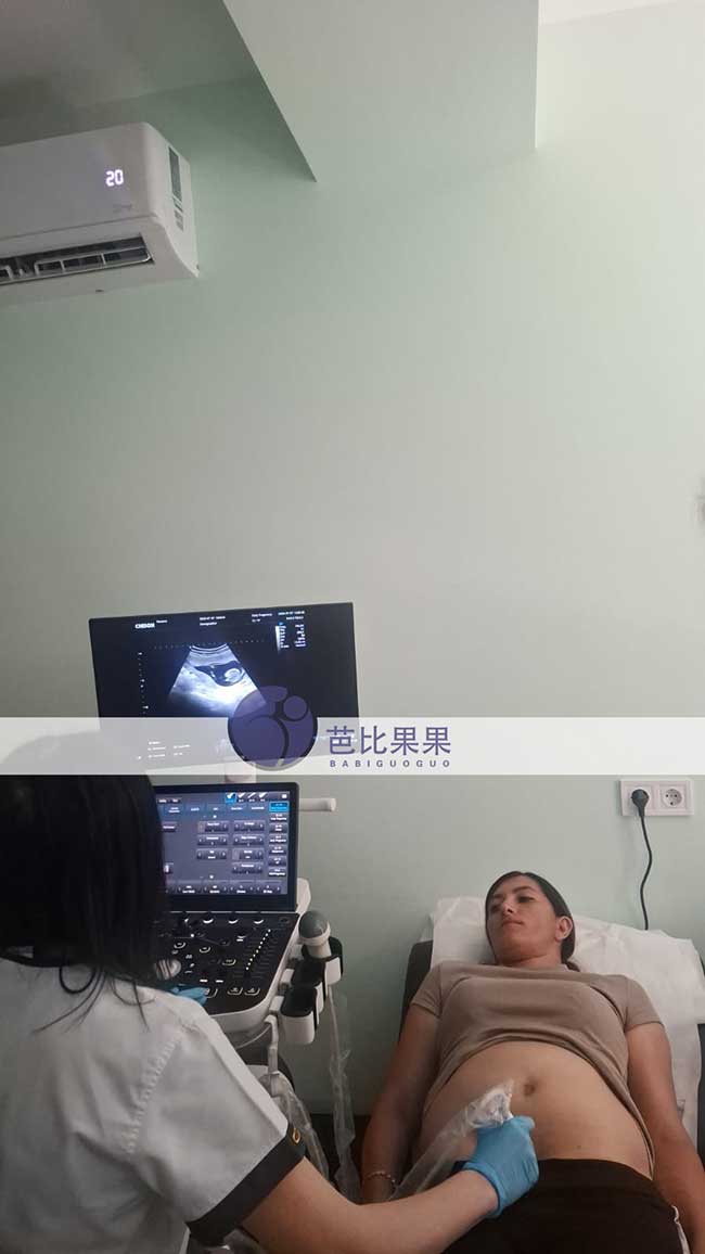 试管妈妈12周孕检
