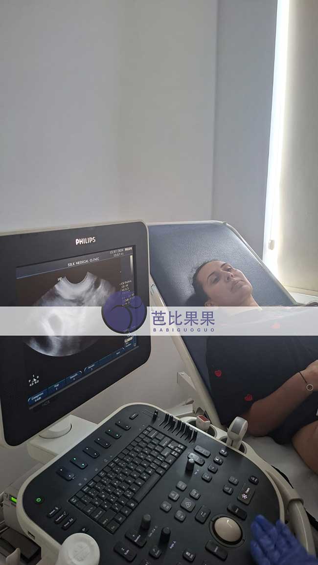 试管妈妈首次B超