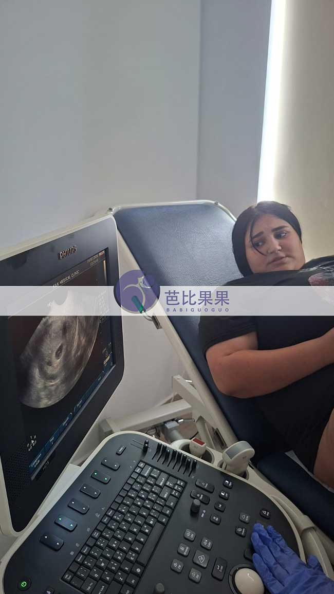试管妈妈首次B超