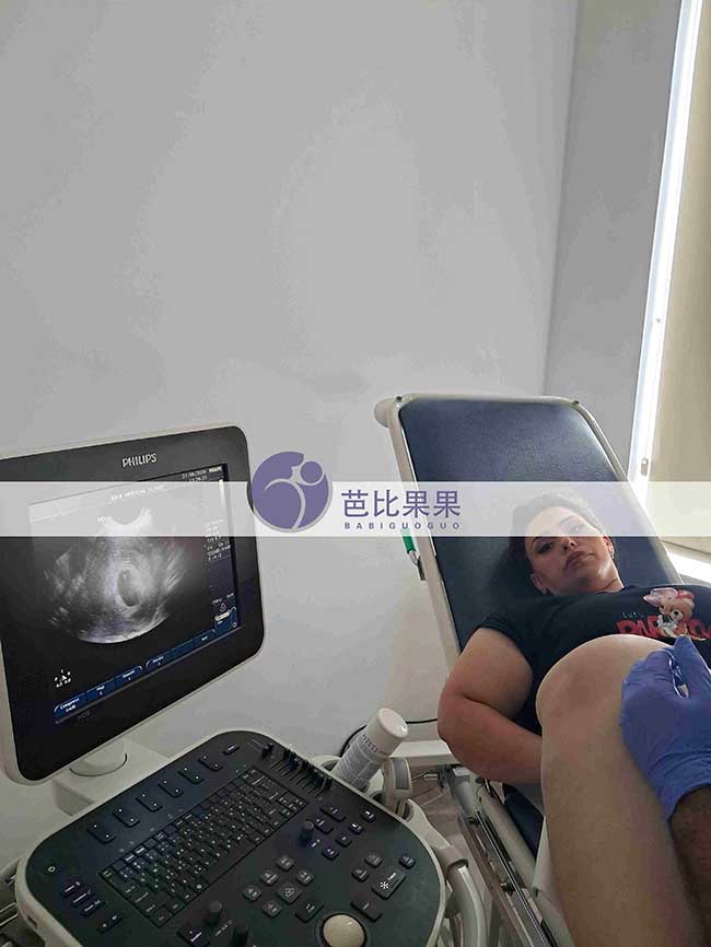 经历长期尝试后，梁女士终于在格鲁吉亚试管旅程中看到第一次胎心
