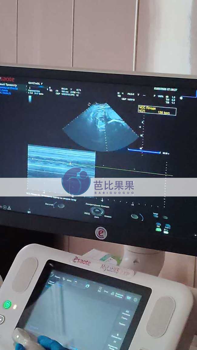 试管妈妈做B超