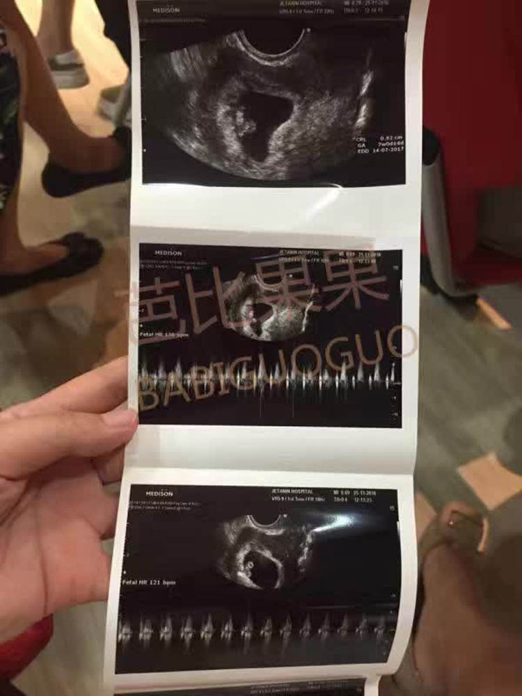 　姐妹在11月3日抽血验孕成功
