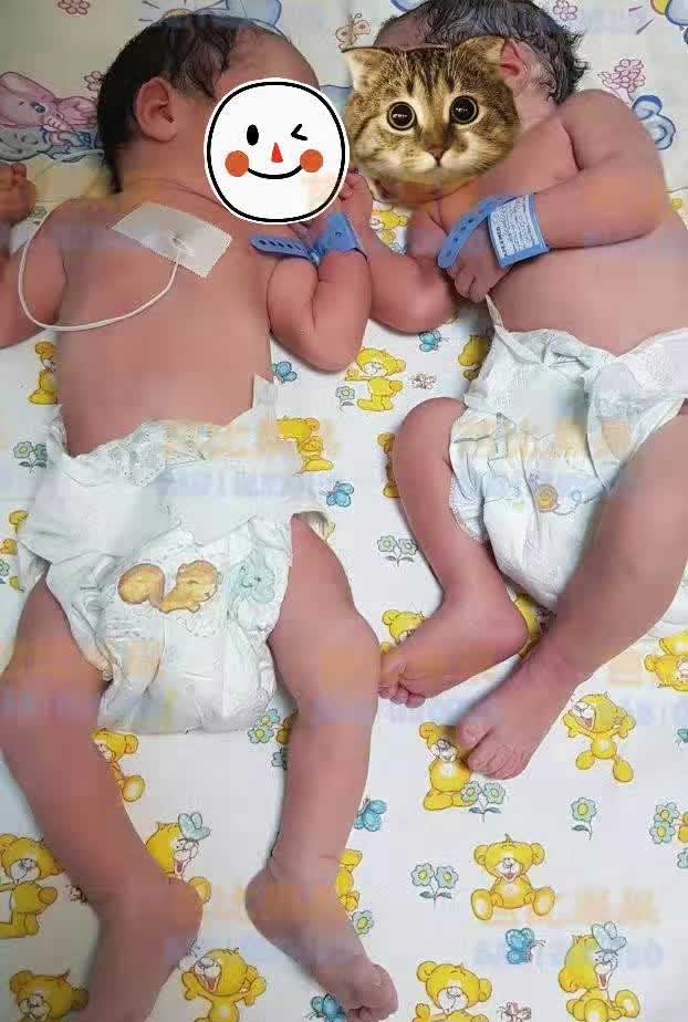 W先生的双胞胎宝贝顺利出生，两个宝宝体重都接近五斤
