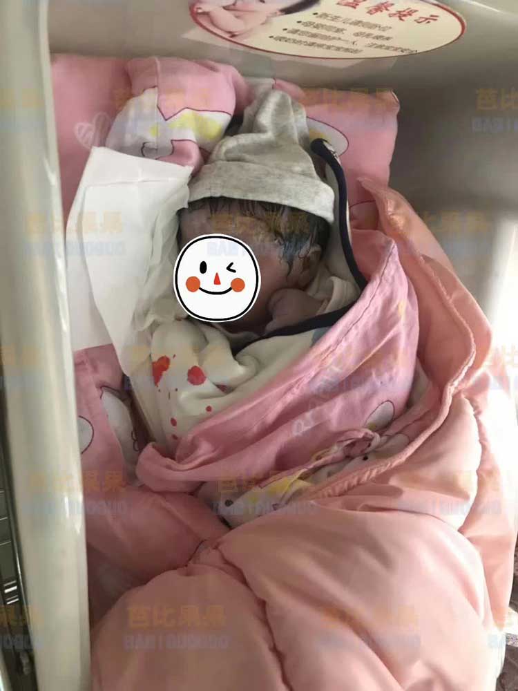 上海H先生的泰国爱心妈妈足月剖腹产生下健康女宝宝